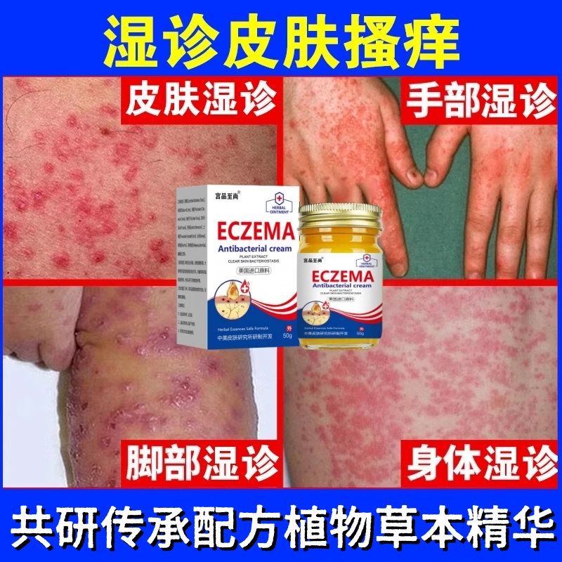 腿上干燥起皮小腿皮肤痒腿部瘙痒越抓越痒全身干痒止痒神器抑菌膏