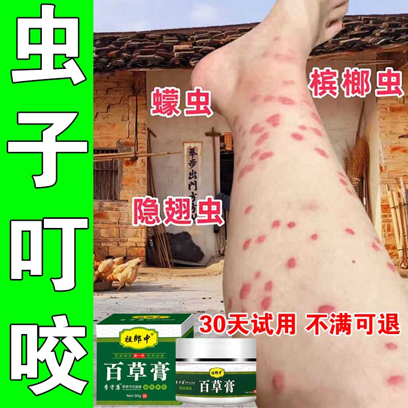 臭虫跳蚤咬蚊虫叮咬止痒消红液蚊子咬儿童成人皮肤草本外用乳膏