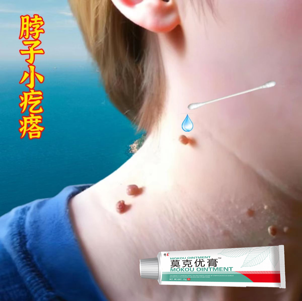 头上长扁平手足寻常疙瘩皮赘脖子腋下肉粒丝状肉钉温和膏