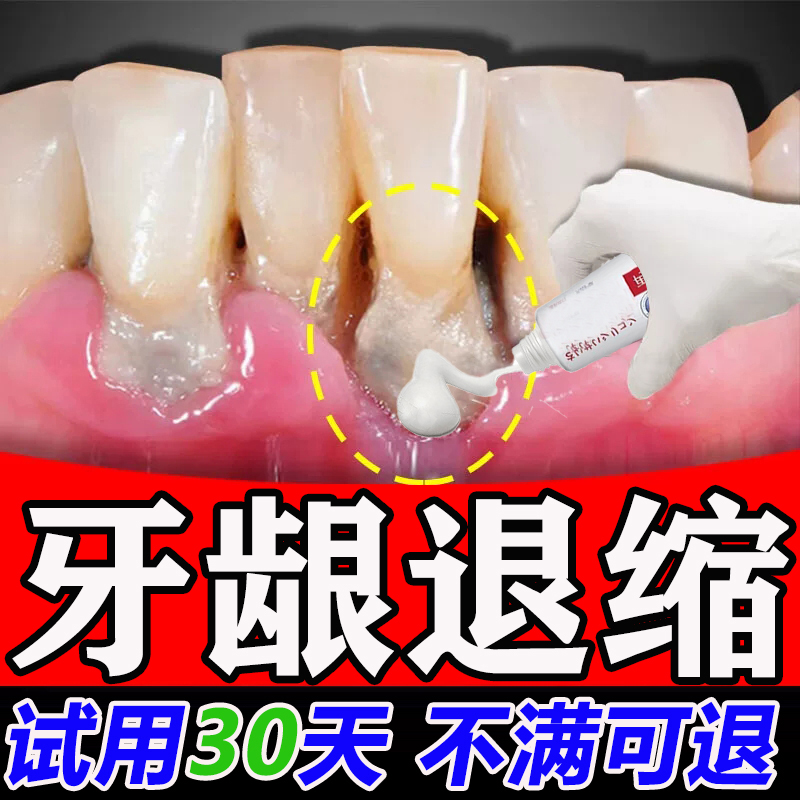 牙龈萎缩专用牙膏牙龈修复神奇牙根暴露牙齿松动牙缝宽护龈固齿 