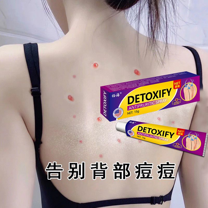 【美国进口配方】毛囊严重毛囊堵塞头上后脑勺前胸背部胸部痘痘膏
