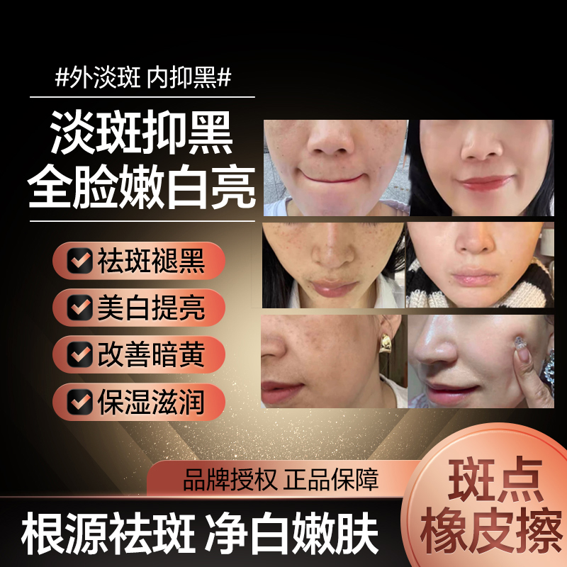 香香（拍一发二）LL699美白祛1班1霜精华新品2024梵玥