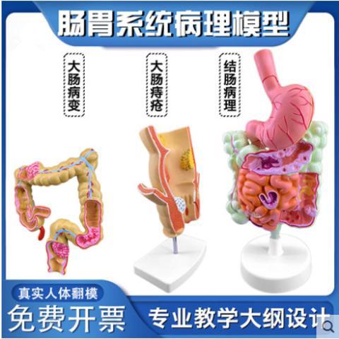 政河人体大肠病理痔疮展示结肠解剖器官结构模型十二指肠胃系统