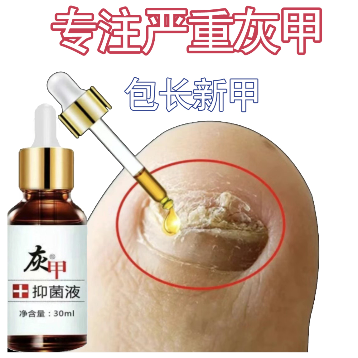 【自家人】灰手甲抑菌  指甲修复套装