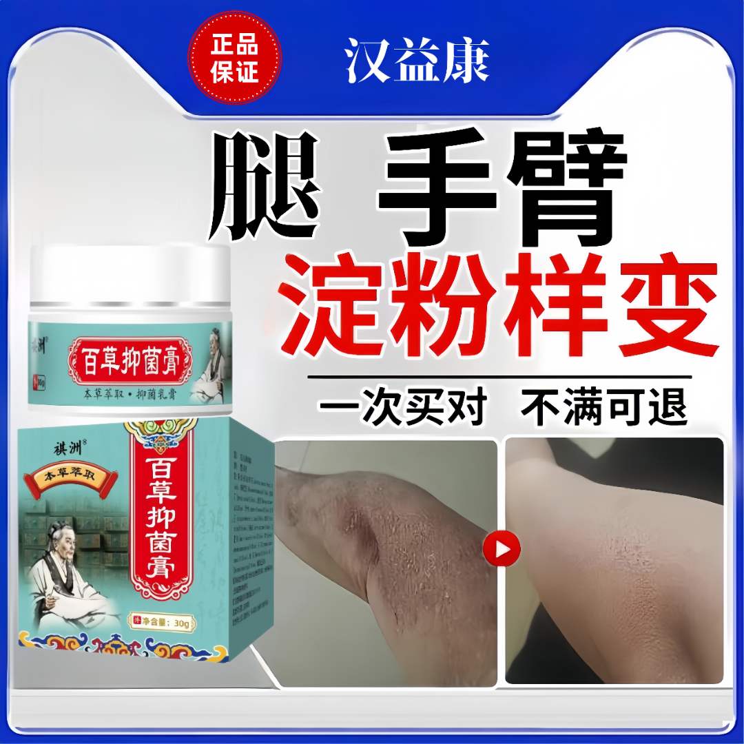 【祺洲】皮肤淀粉样变小腿胳膊粗糙瘙痒后背淀粉样变干燥止痒专用霜