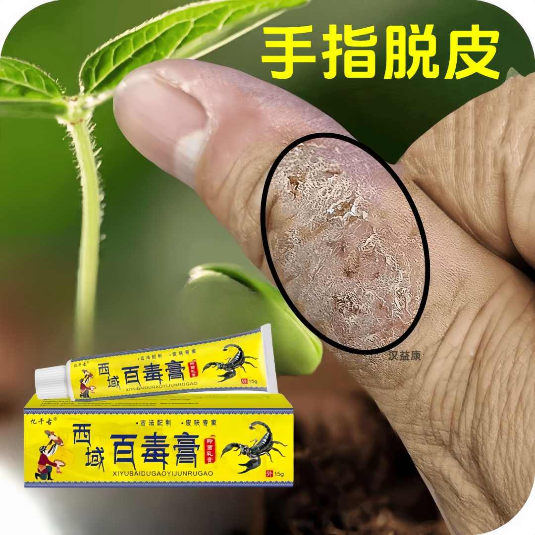 手足脱皮膏正品干裂手掌硬皮鹅掌风抑菌止痒乳膏专用特效克星凝胶