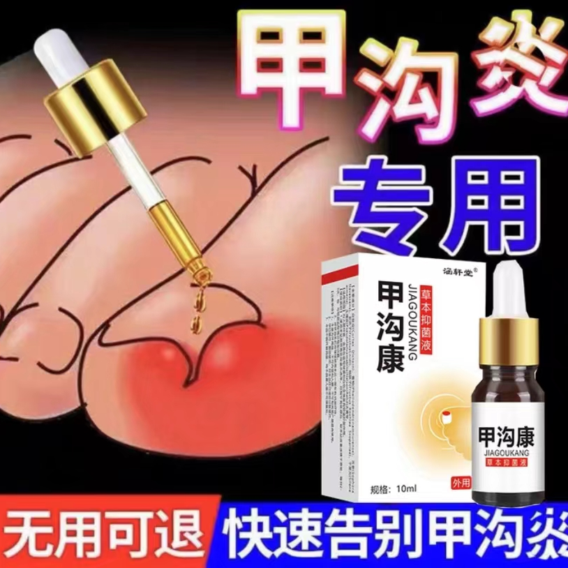 指甲长肉里甲沟软甲脱甲脚趾甲化脓嵌甲肉芽脚指头疼甲沟膏