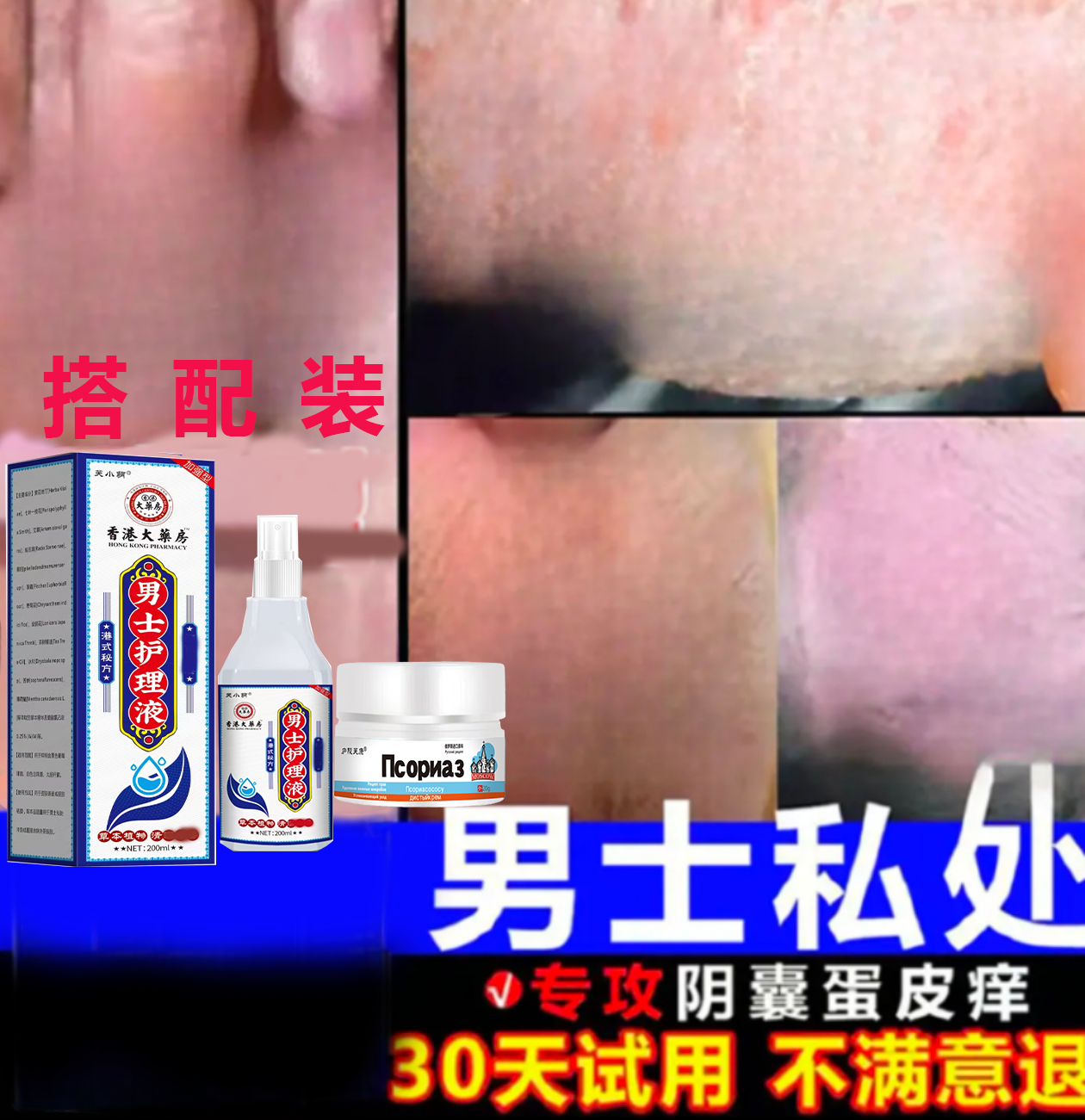 男人私处蛋蛋痒阴部~潮~湿`下体大腿内侧痒起乌龟皮疙瘩痒止痒膏