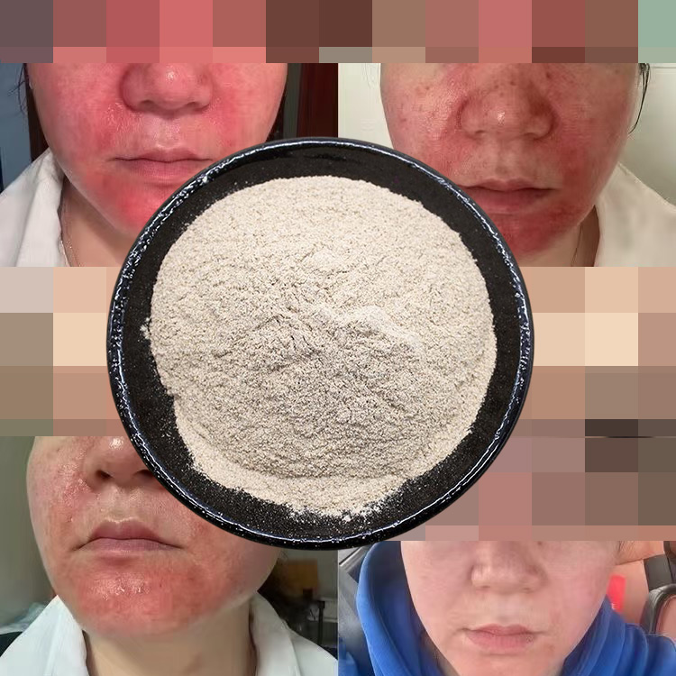 【激素脸专调】草本面膜粉优质超细粉