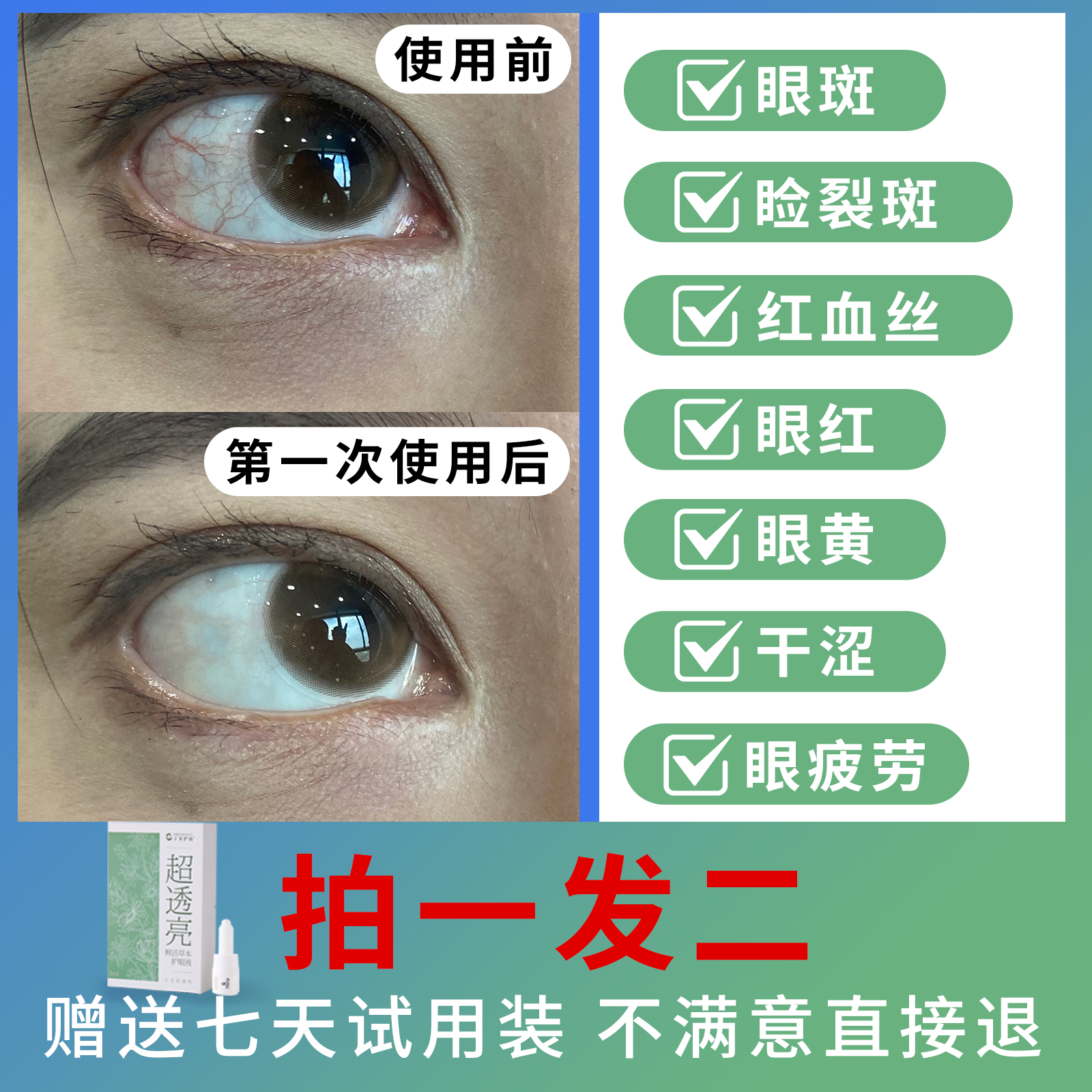 睑裂斑叶黄素缓解眼疲劳眼黄干涩眼睛模糊眼部红血丝明目液护眼贴