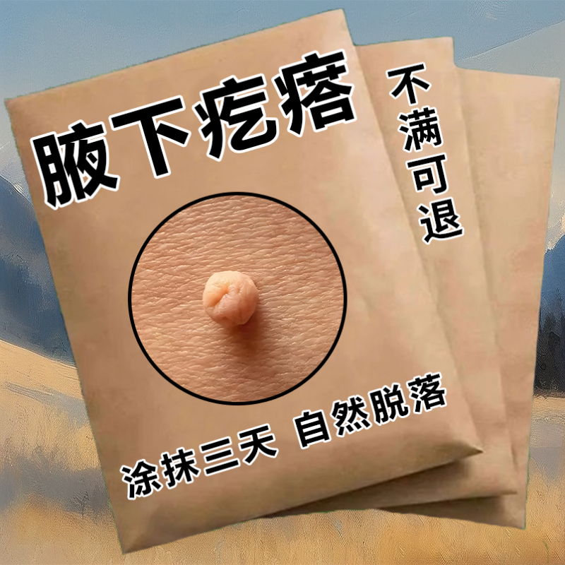 【草本皂】皮肤凸起颗粒脖子腋下粉刺痘痘皮肤外用手工正品香皂R