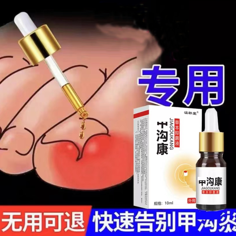 指甲长肉里脚趾脓嵌甲肉芽脚指头疼甲沟膏 