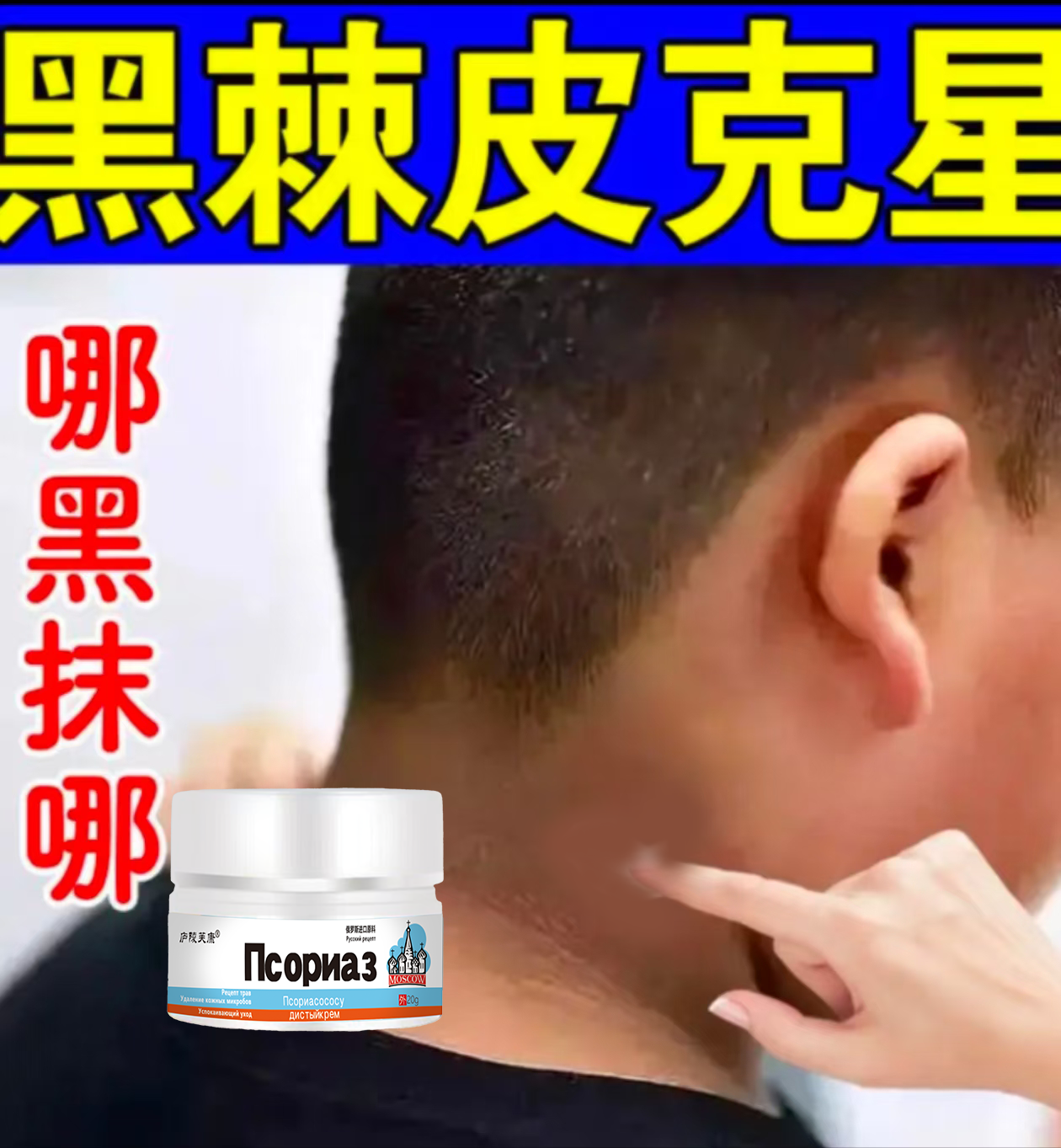 去全身嫩白黑棘皮脖子黑腋下黑大腿肩颈臀部坐印黑~色~素~沉淀膏