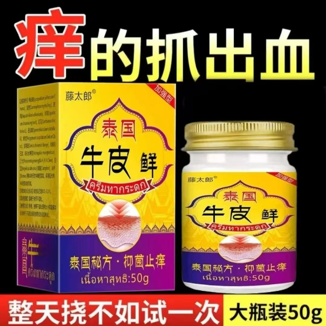 银屑牛皮膏顽固牛皮肤痒鳞屑手足红点大腿内侧痒止痒草本抑菌乳膏