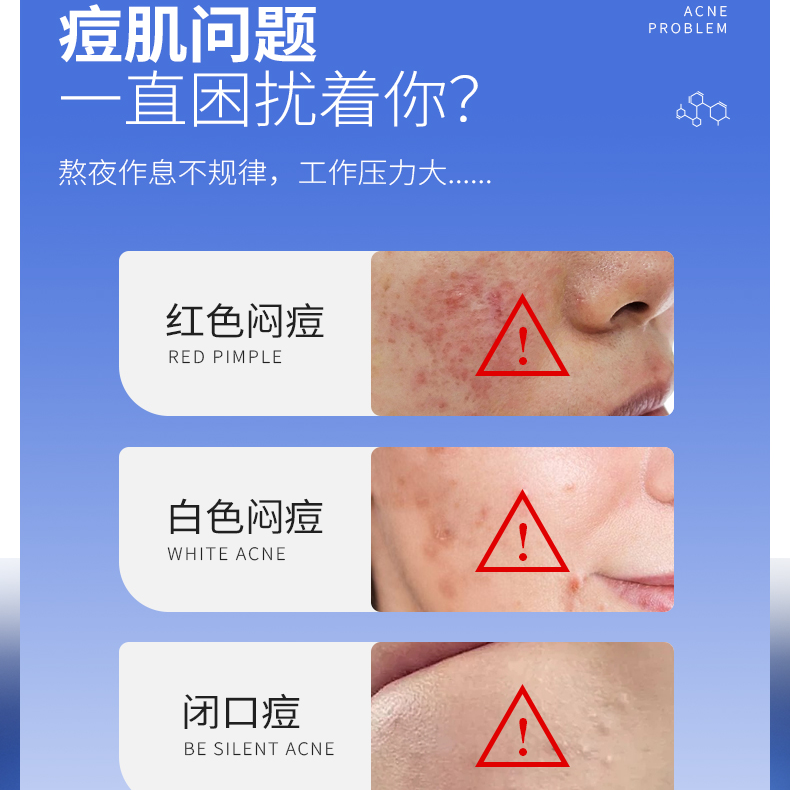 瑞康壬二酸净颜专研乳水杨酸祛痘膏烟酰胺祛痘面霜凝胶滋润通用