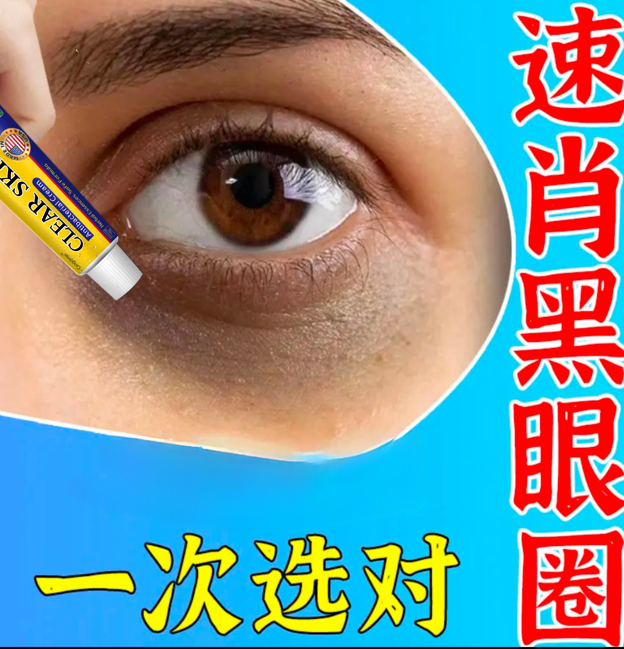 长期黑眼圈眼康膏黑色素沉淀眼袋眼膜细纹熬夜草本