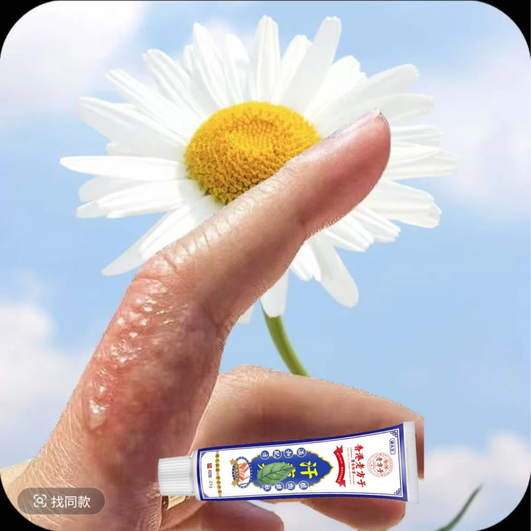 汗珍泡手上起小水泡止痒膏脱皮抑菌克星手指缝痒干裂专用草本乳膏