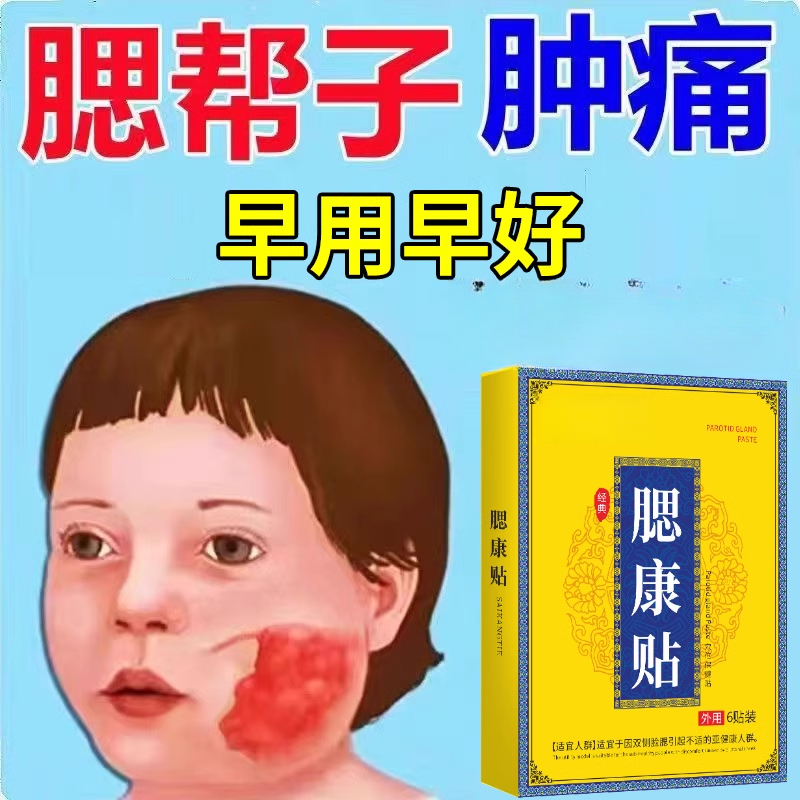 腮康贴成人儿童痄腮脸颊肿痛耳后硬腮帮子疼身体护理贴家用外用