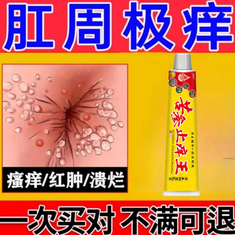 肛周门反复痒肛周围屁眼痒男女屁股越抓越痒肛潮湿瘙痒的抑菌软膏