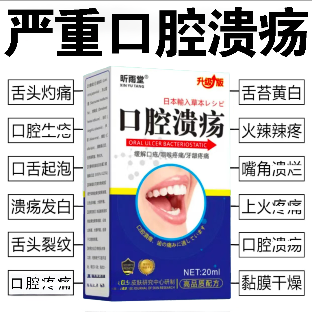 口腔溃疡喷剂嘴巴上火口臭异味气泡糜烂口舌生疮痛消焱消肿清热