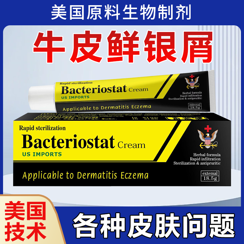 【美国牛皮膏】银屑牛皮生物制剂专用止痒膏头皮手足外用真菌乳膏