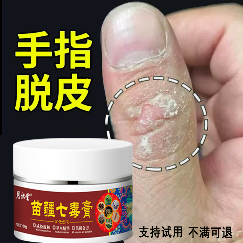 手脱皮膏手足干裂脱皮克星草本抑菌膏四季修护神器抑菌止痒涂抹膏