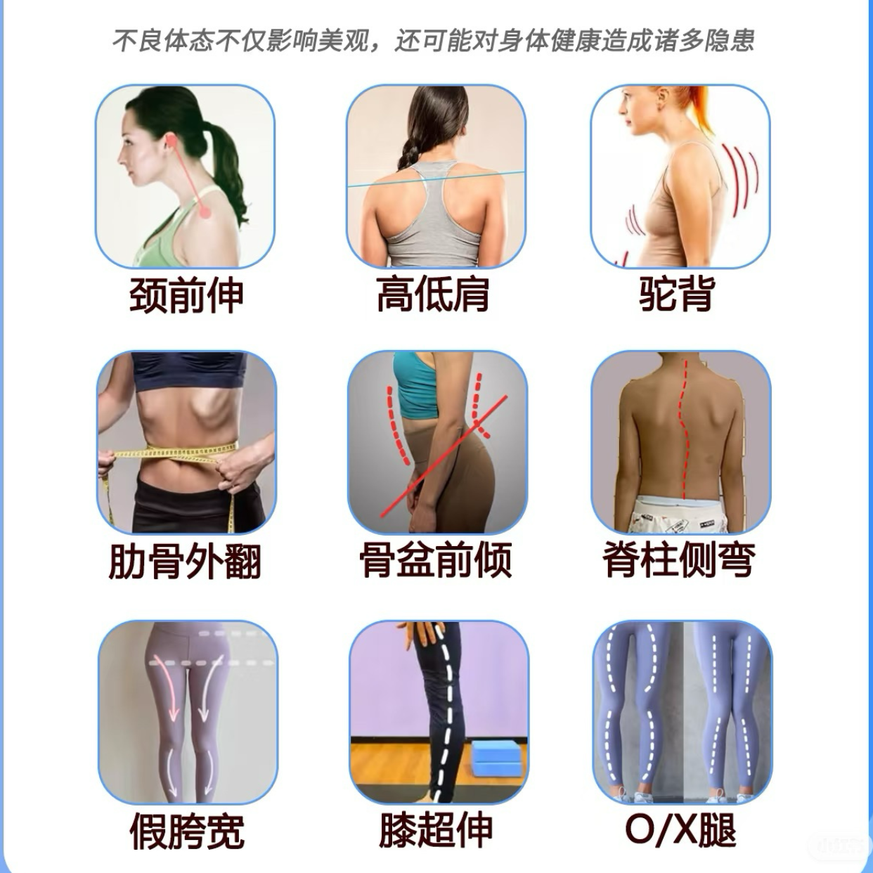 【苹果专拍】体态评估
