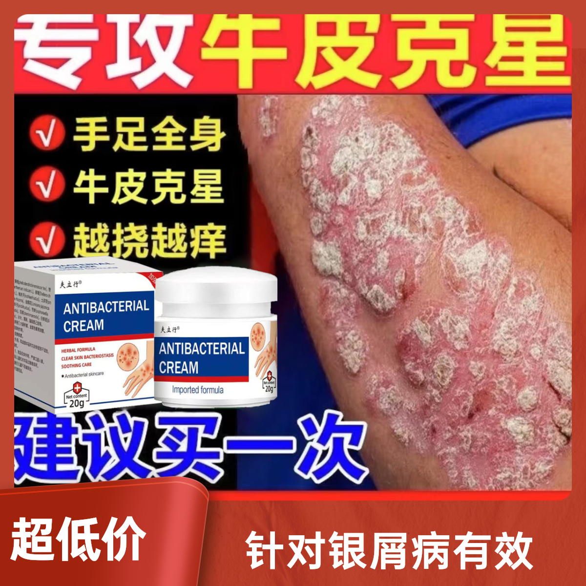 【正品牛皮廯】牛皮廯顽固手足体股廯红点止痒大腿内侧痒外用乳膏