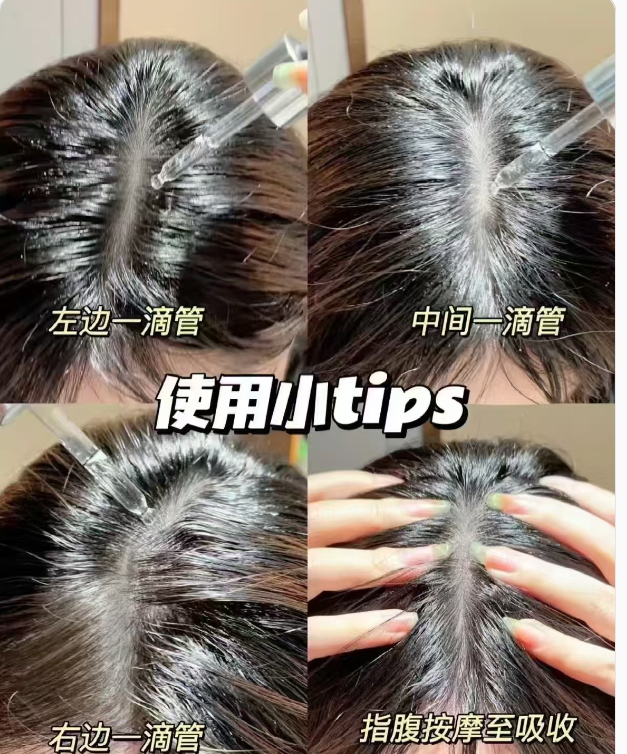 7.7专拍！！！大韩推荐 头皮钛精华