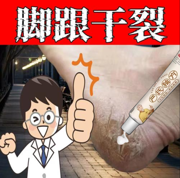 【尼卡专属】足裂口脱皮开裂口子痒手足防裂脚后跟干裂止痒