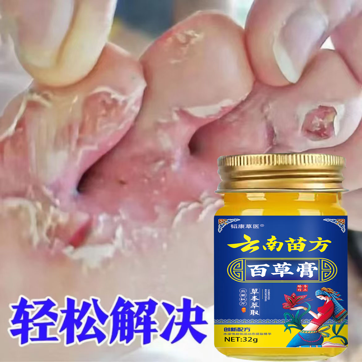 止痒膏脚出汗脱皮涂抹干裂脚趾缝痒抑菌止痒神器足部护理止痒软膏