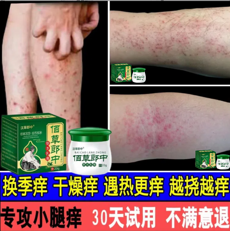 腿上皮肤干燥发痒小腿皮肤痒秋冬天腿上很痒越抓越痒止痒膏草本