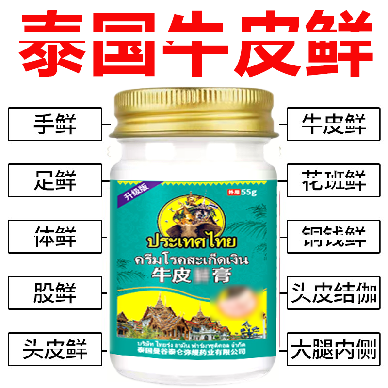 泰国牛~皮膏皮肤~痒红~点大腿内侧~痒~止~痒草本涂抹膏