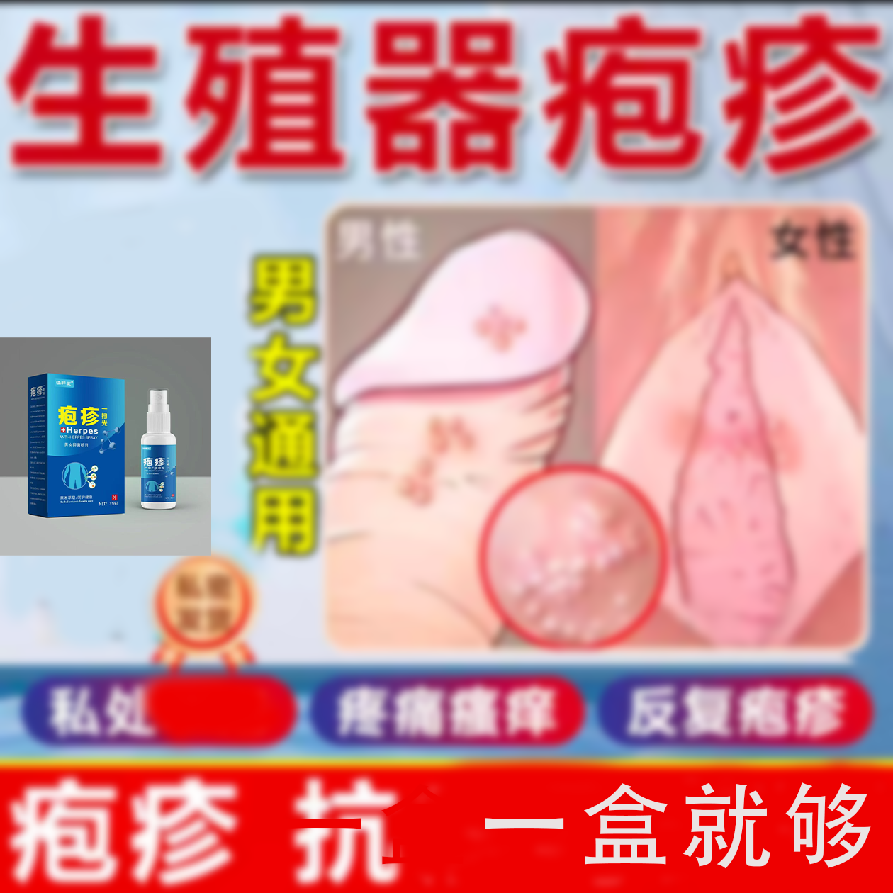 私处 男女疼痛瘙痒 疱疹 抗真菌感染止痒一盒就够