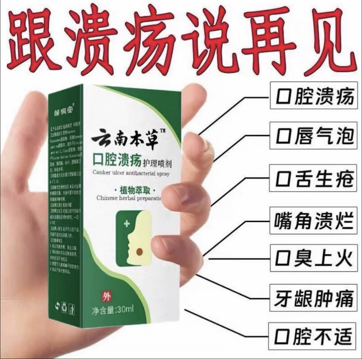 云南本草口腔溃疡抑菌喷剂嘴巴上火口臭起泡糜烂异味口舌生疮痛