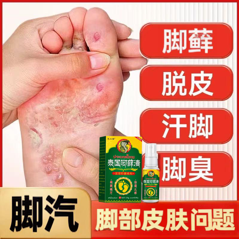 脚痒脚臭脚脚部出汗脱皮起水泡干裂草本萃取抑菌止痒喷剂