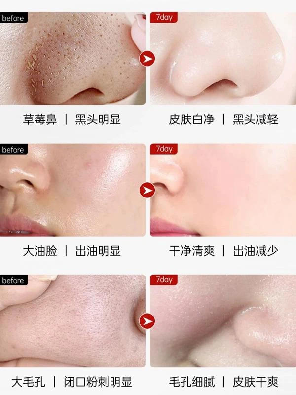 变美的秘密--女神必备古法草本植萃