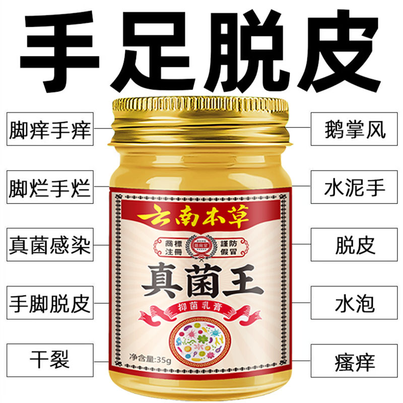 云南真菌王皮肤瘙痒手足干痒脱皮干裂开裂草本止痒手痒舒肤防裂膏