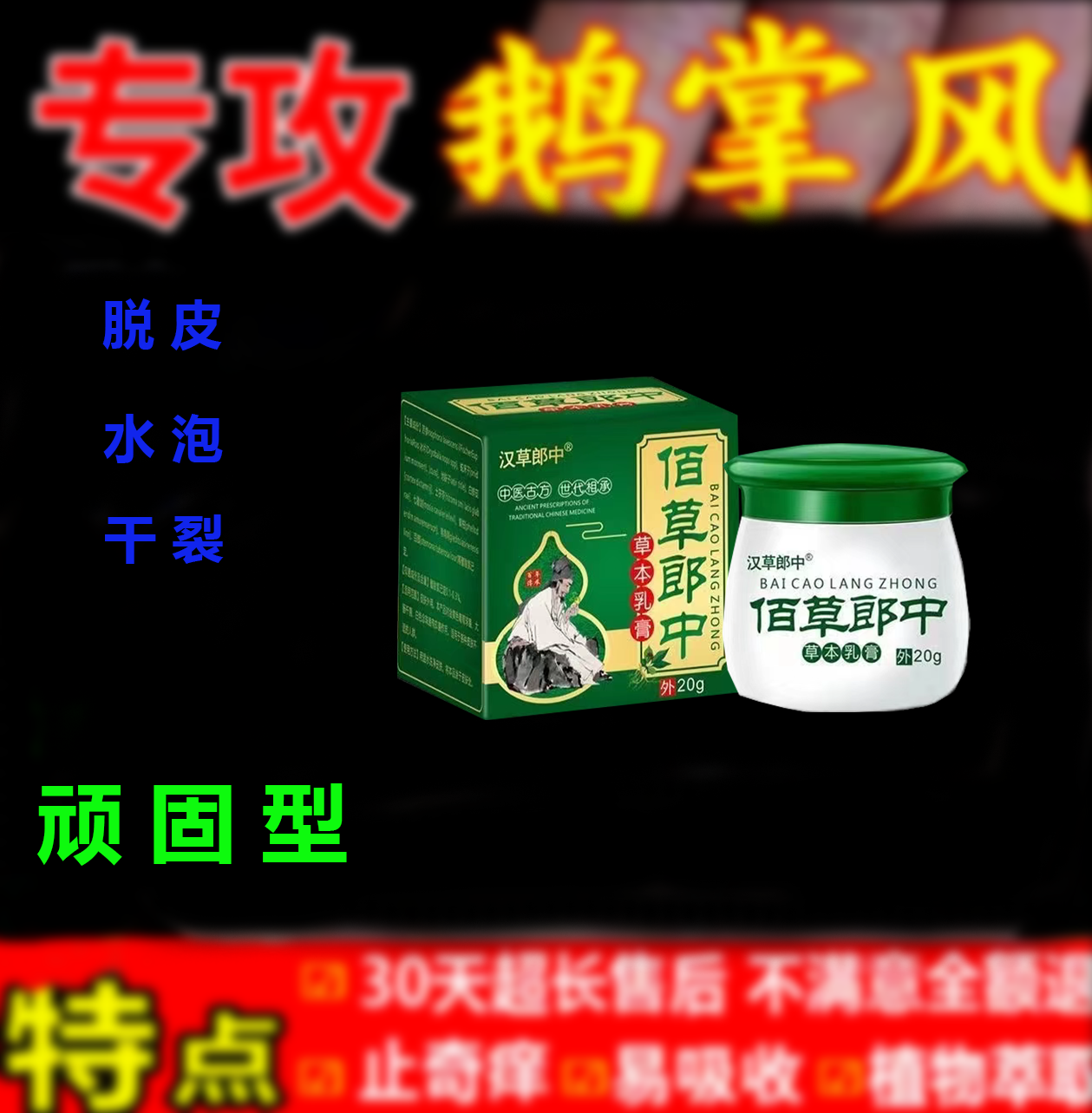 鹅掌风手指脱皮膏鲜正品手掌止痒开裂专用特效干裂克星