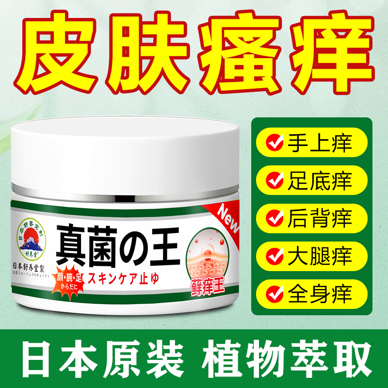 日本真菌王止痒抑菌皮肤瘙痒蚊叮咬手脚水泡脱皮草本温和抑菌乳膏