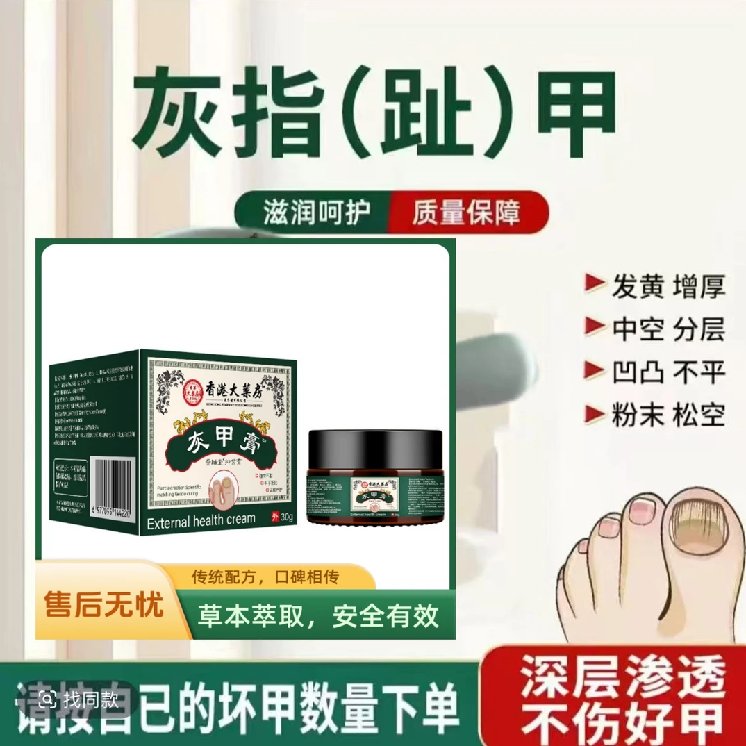 灰指(趾)   甲    膏抑菌膏指甲膏植物萃取直售-X1
