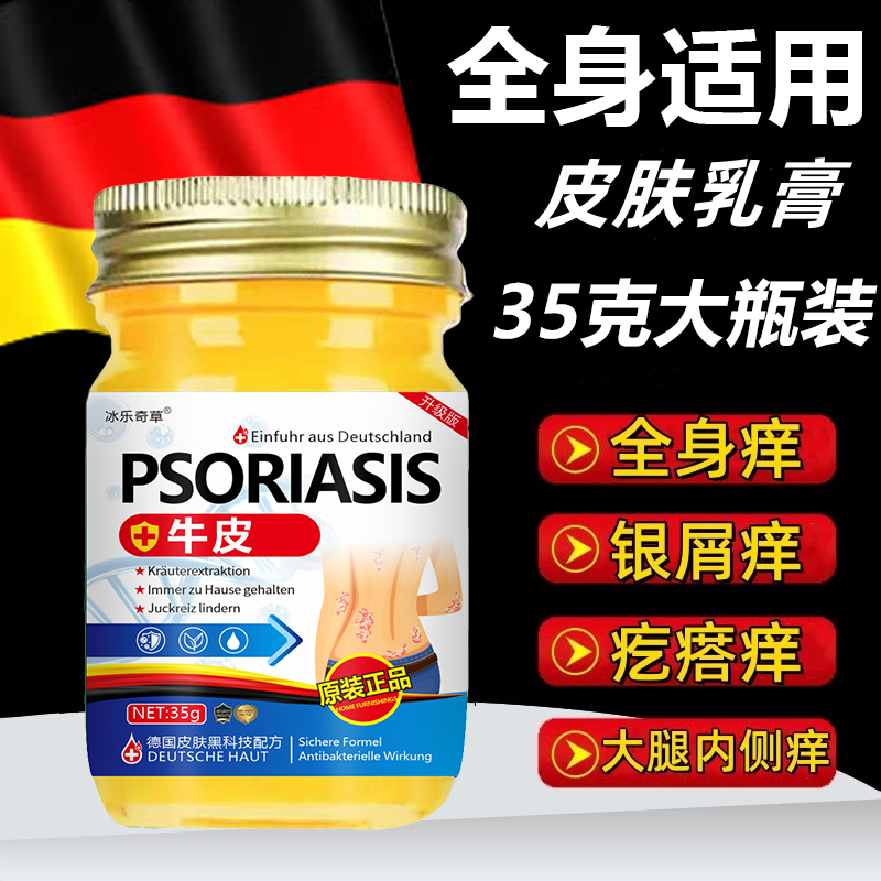 【德国正品】全身牛/皮/银/屑/鲜手足头体股大腿内侧草本乳膏