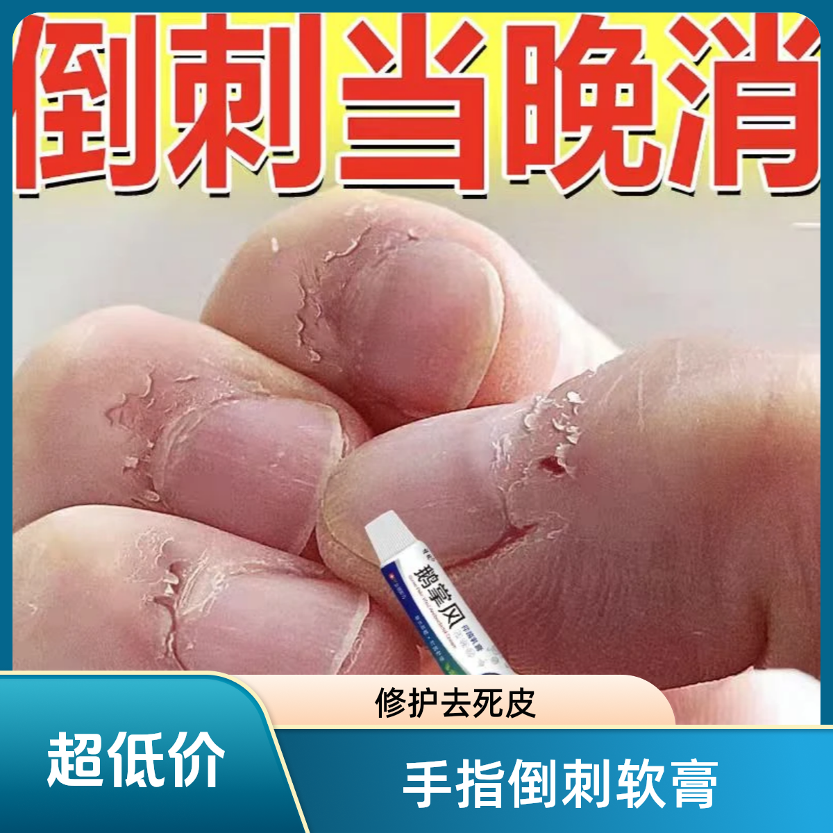 手指长倒刺肉刺指甲边缘发硬起肉刺修复软化去死皮修护软膏