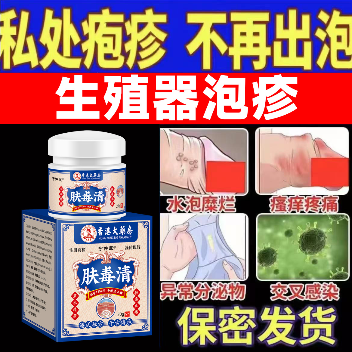 生殖疱疹防复发病毒性单纯疱疹男女性病水泡溃疡红斑带状泡诊
