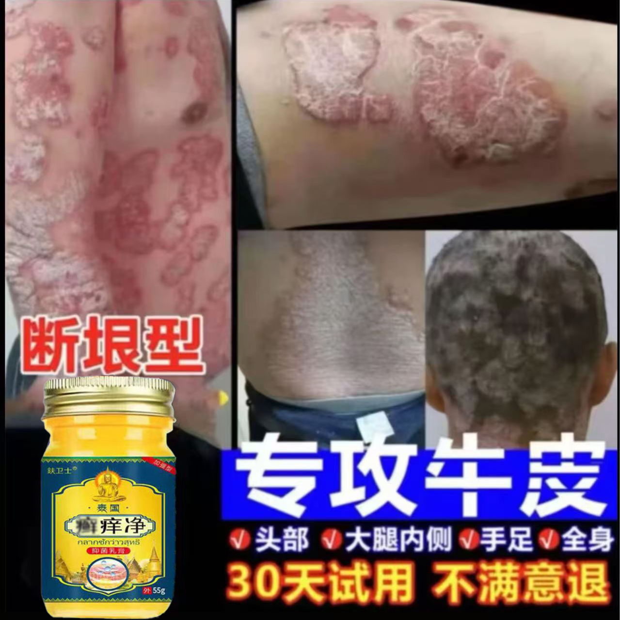 【泰国廯痒净】牛皮廯肤顽固手足体股廯红点止痒痒外用乳膏直播间