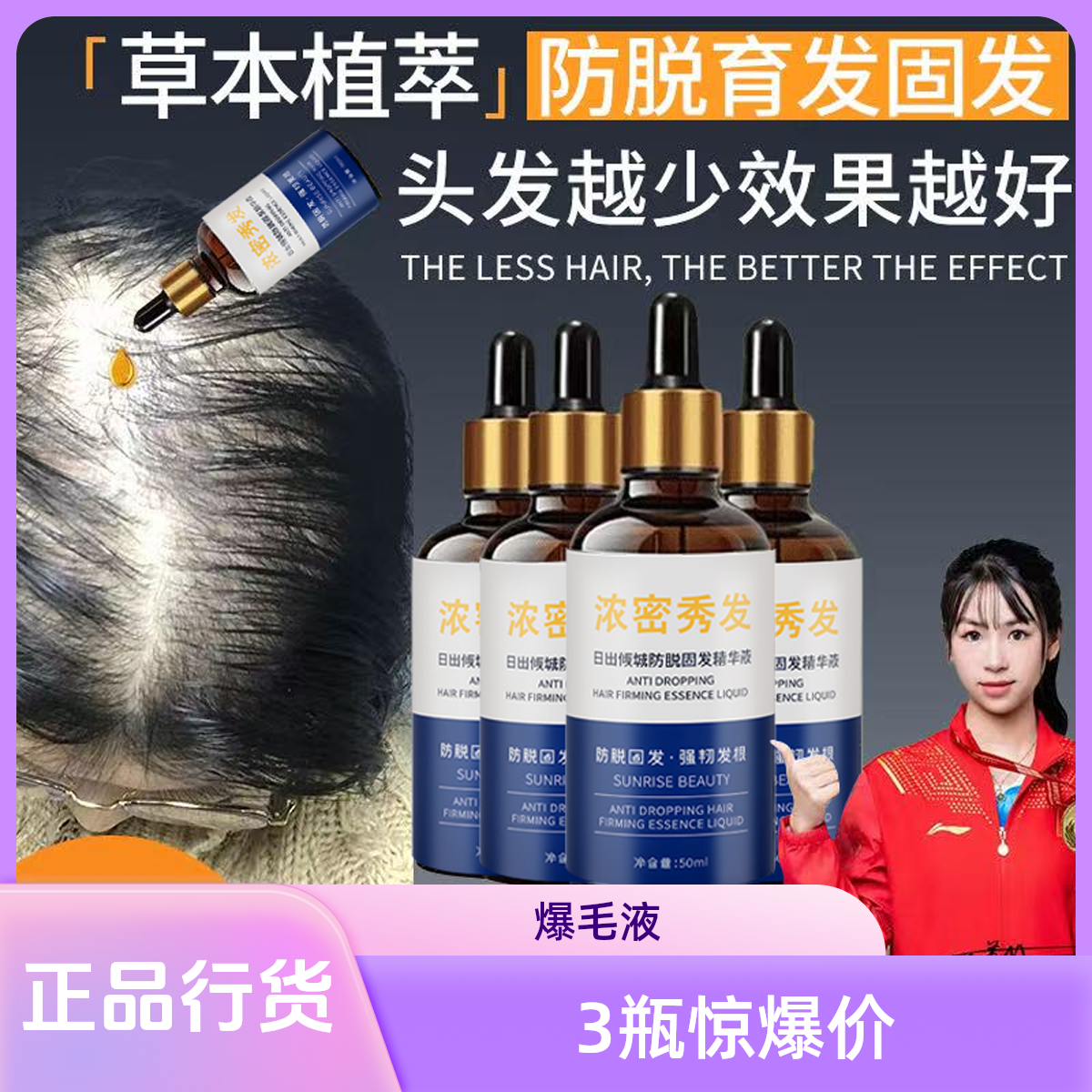 爆毛液【3瓶小面积防脱养发固发液男女通用】草本精华50ml*3生发液