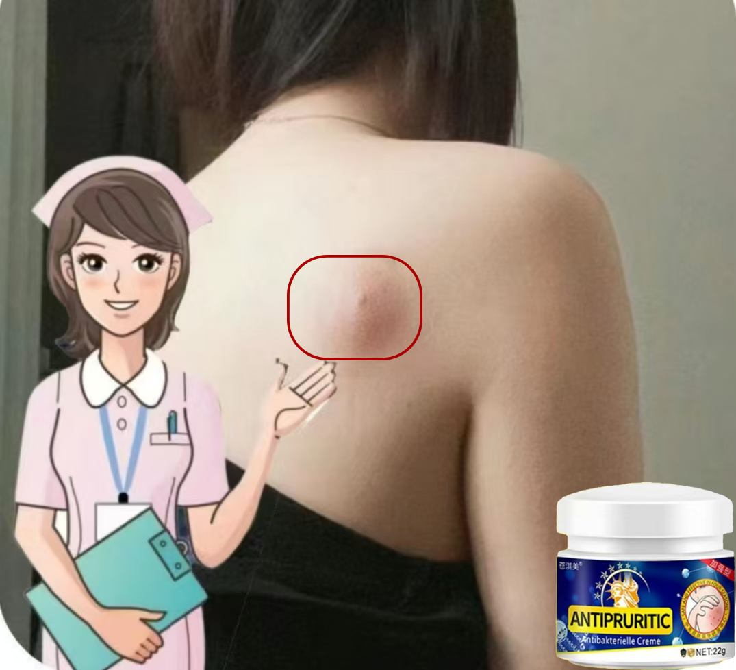 火.疖.子.硬.块.脓.包红疙瘩坐板疮