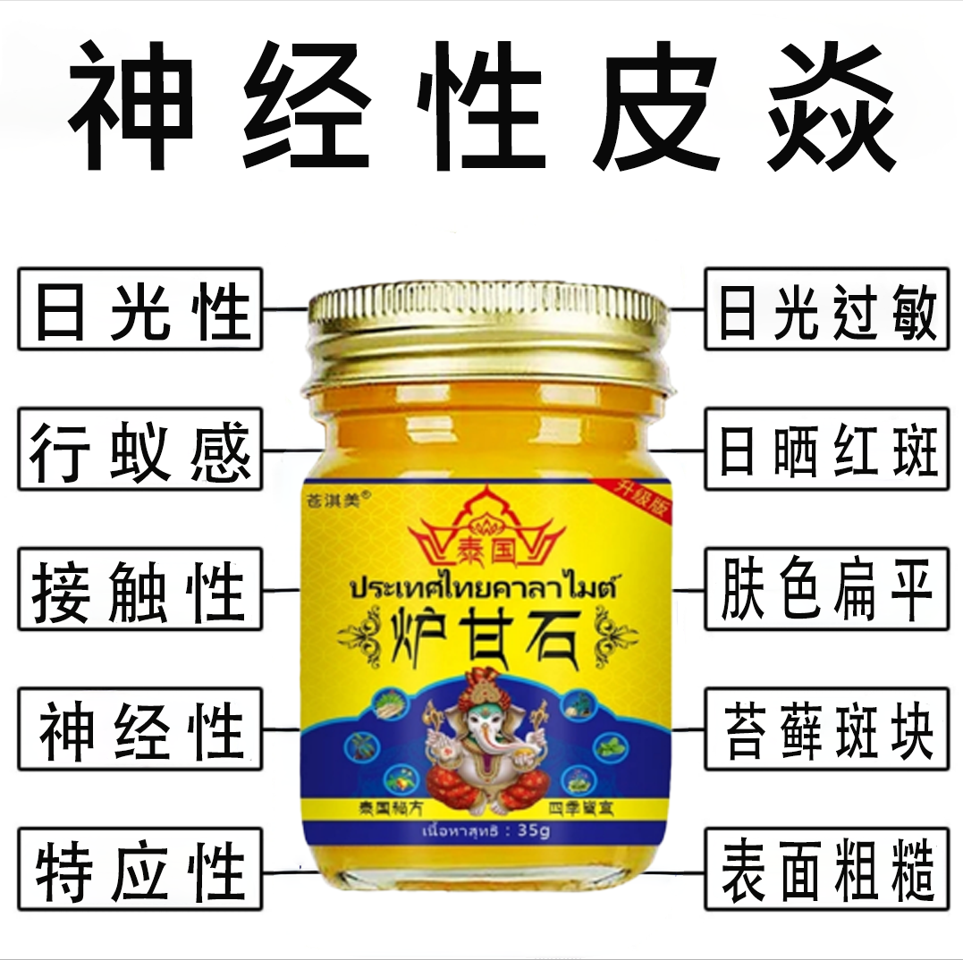神经性皮.焱日光性脂溢性神经性日光过敏日晒红斑