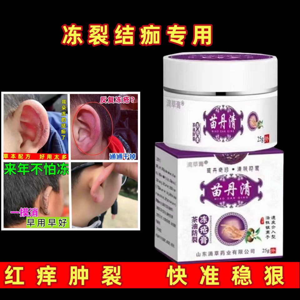 冻疮膏25克成人儿童冬季冻耳朵手脚脸部痒红肿干裂膏止痒消包消肿