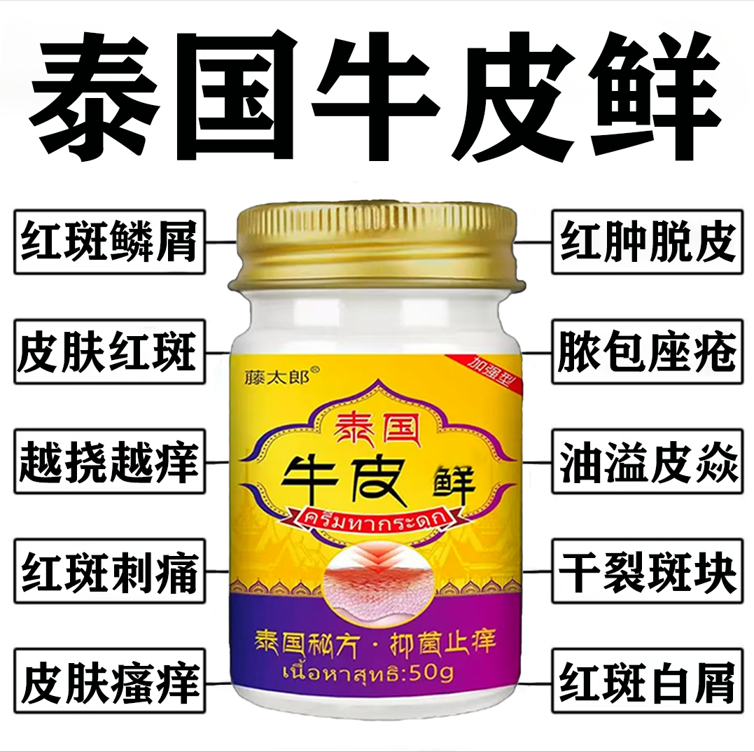 牛皮膏王银痒痒膏屑手足大腿内侧全身外用抑菌皮肤膏草本 买2送1